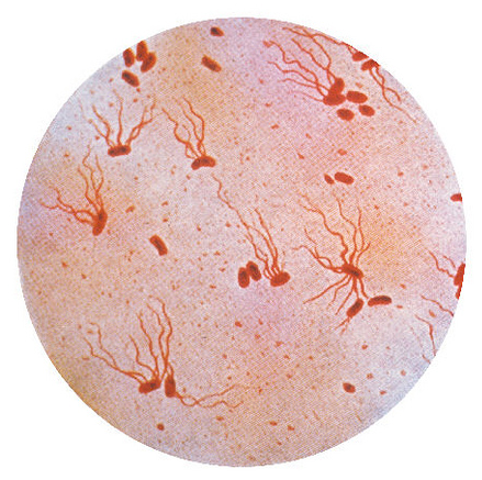 Salmonella Typhosus